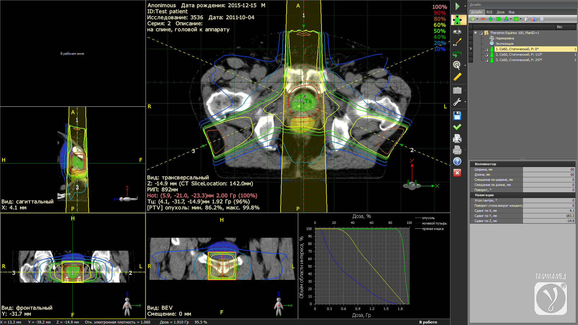 Выбор коллекции рентгеновских компьютерных томограмм (DICOM) для проведения планирования